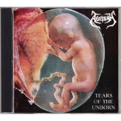 APOPLEXY Tears Of The Unborn / Dysmorphophobia  [CD]
